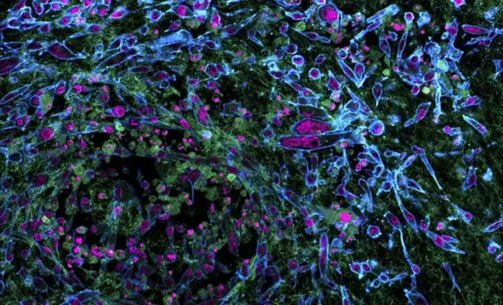 Выява: Marie Irondelle — Philippe Chavrier — Nikon Imaging Center / Institut Curie — Cnrs